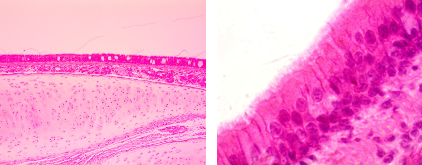 <p>Pseudo stratified columnar epithelialium</p>