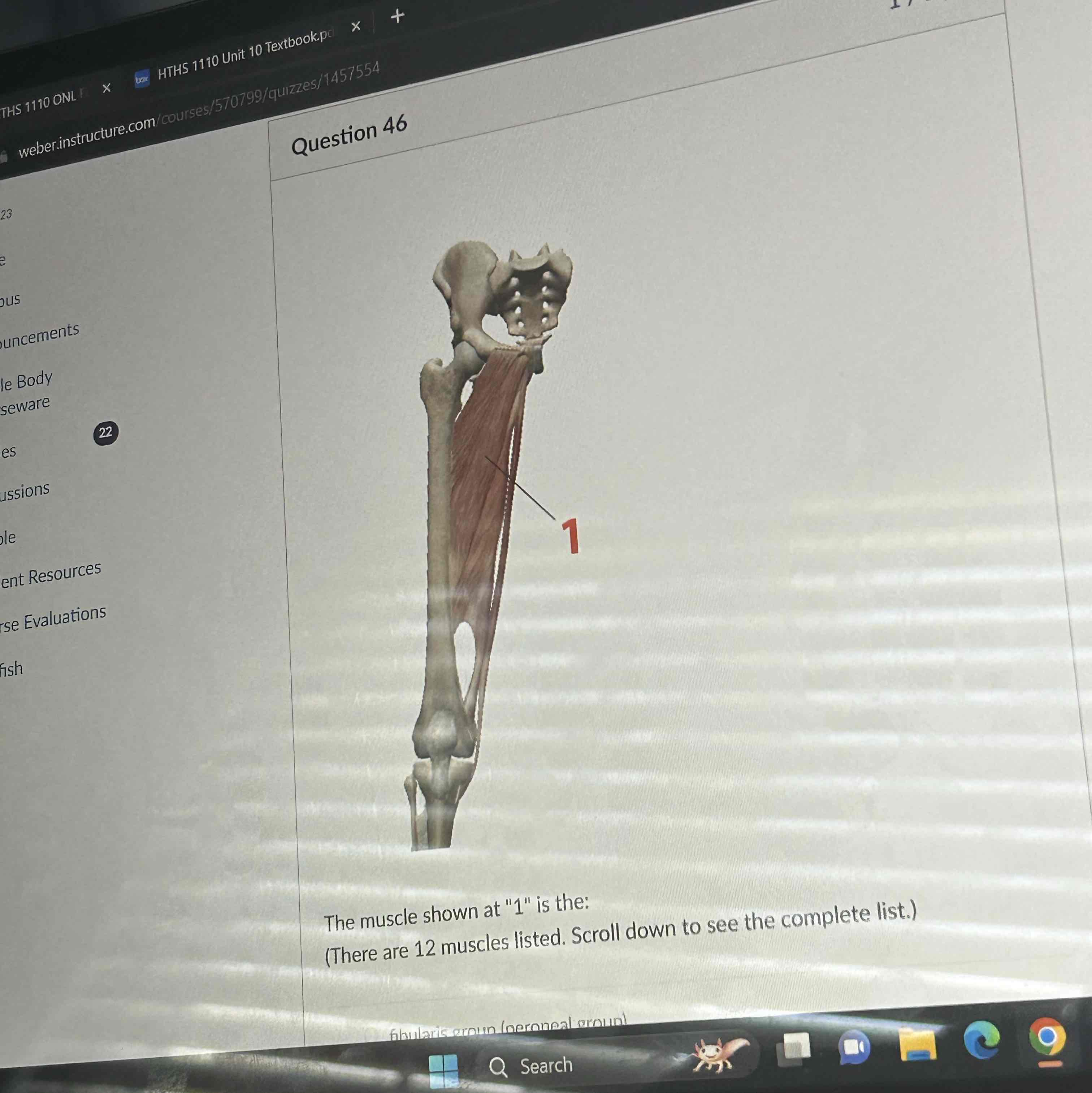 <p>The muscle shown at 1 is the </p>