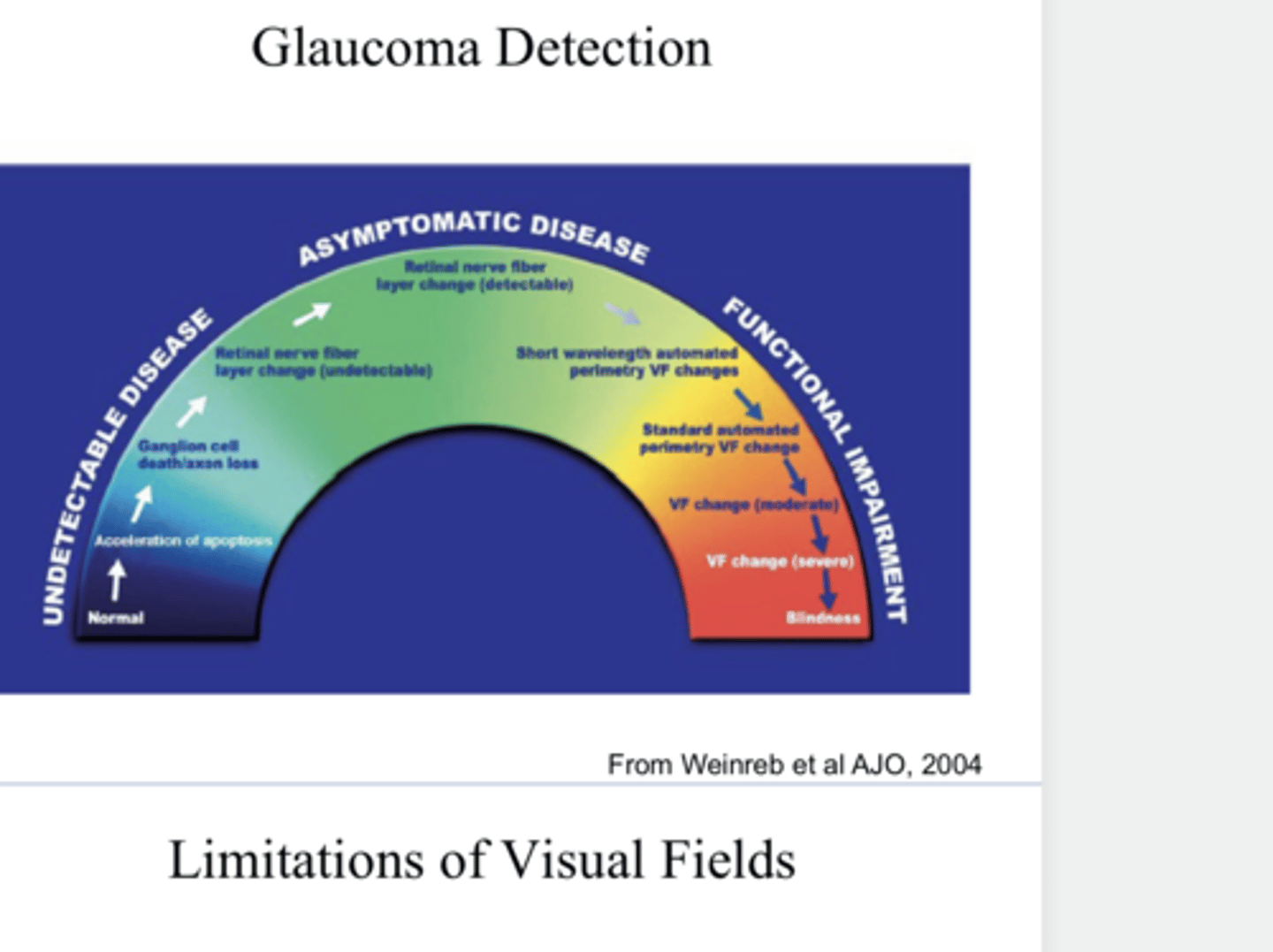 <p>Glaucoma Detection Model (Pic)</p>