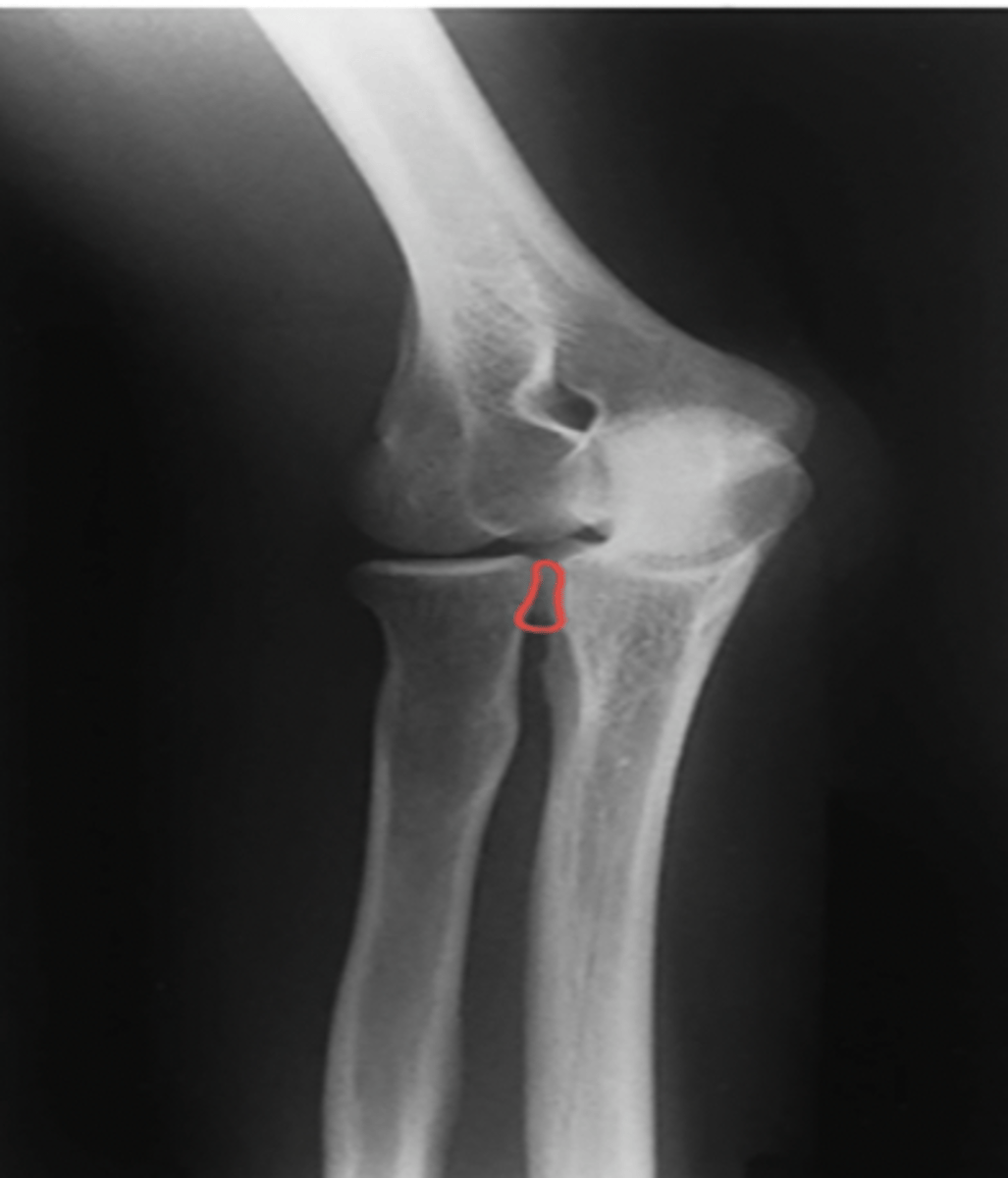 <p>What structure is highlighted?</p>