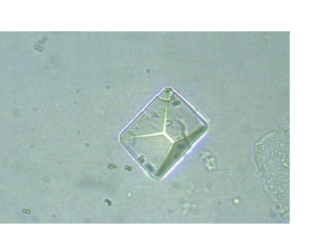 <p><span>Colorless, prism, or coffin-</span></p><p><span>lid shaped</span></p><p><span>Highly alkaline urine and</span></p><p><span>urinary tract infections</span></p><p><span>(UTIs</span></p>