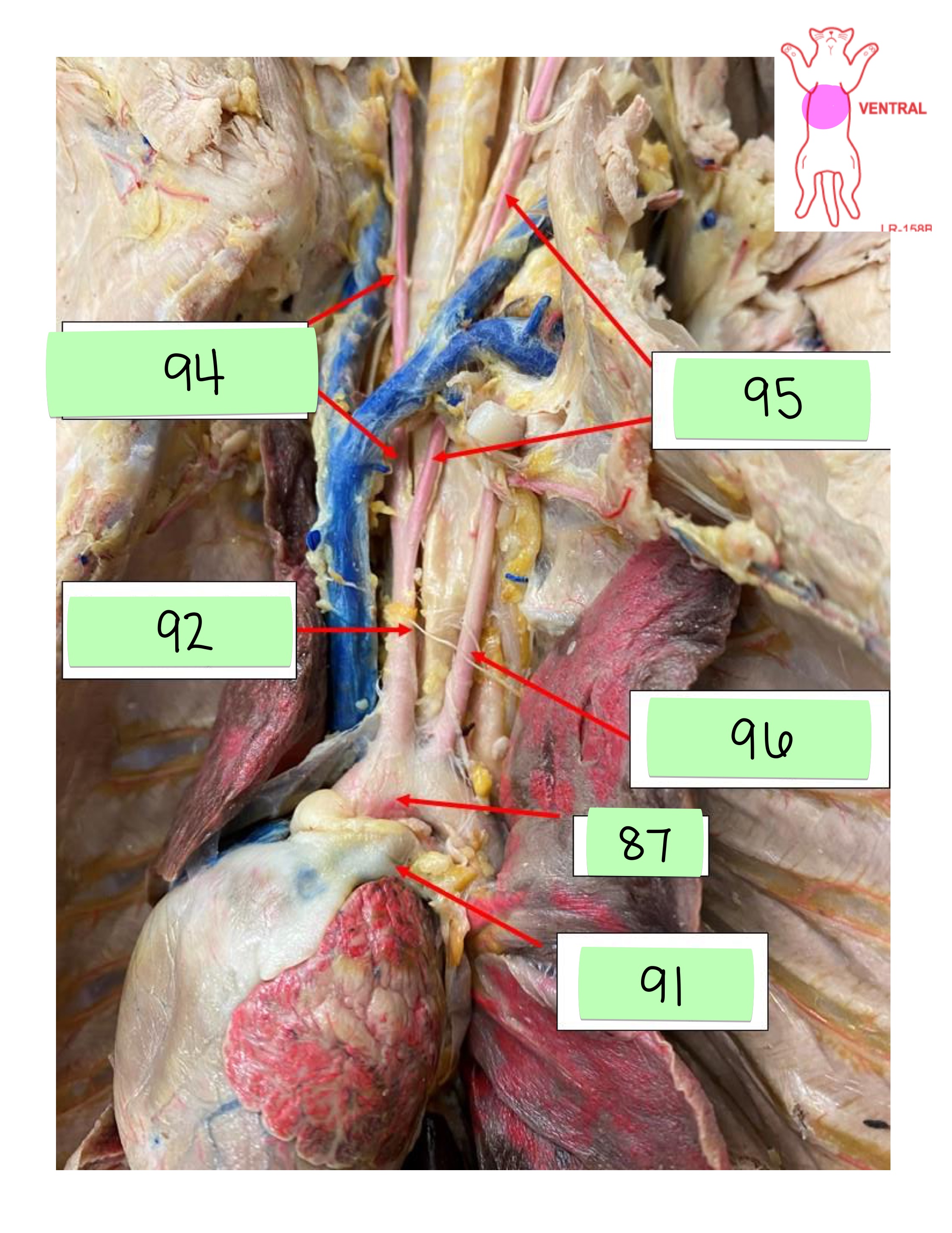 <p>right common carotid artery</p>