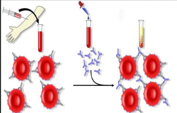 <ol><li><p>Name the test</p></li><li><p>The result of reaction seen as …….</p></li><li><p>The test is used for ……</p></li></ol>