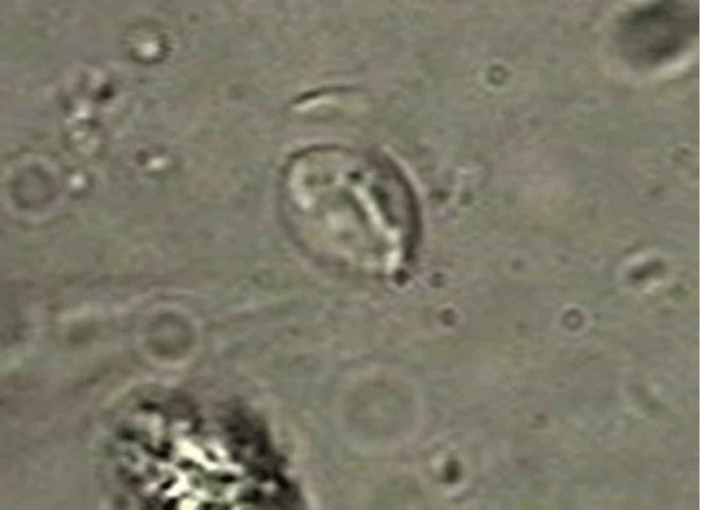 <p>Identify this protozoan mastigophora cyst found in feces on a flotation.</p>
