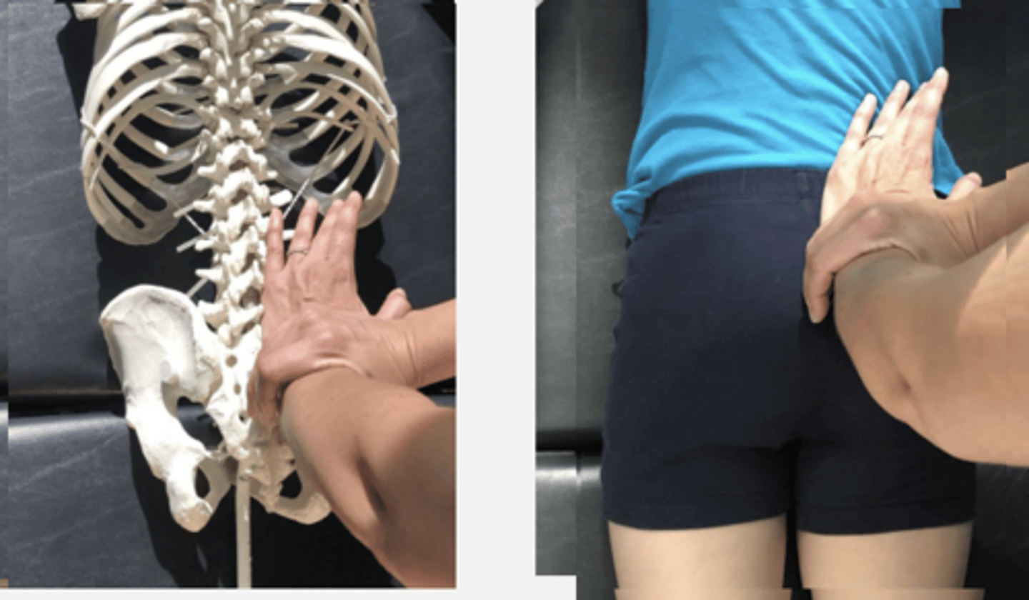 <p>PP: Prone- verbalize how you found the segment</p><p>DP: Modified fencer stance on same side of dysfunction</p><p>CH: Caudal (L) hand, hypothenar (pisiform) on superior margin of sacral base just medial to PSIS</p><p>IH: Reinforcing CH</p><p>LOD: P-A, I-S</p>