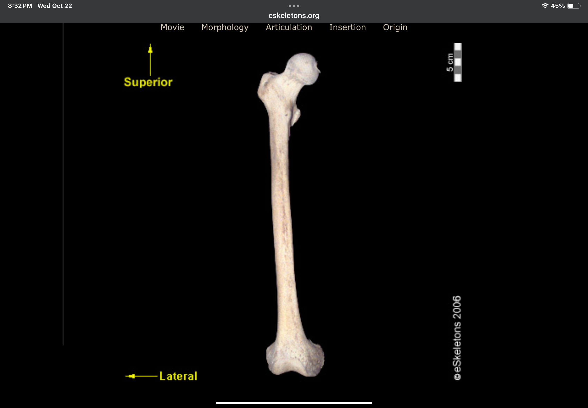 <p>Bone?</p>