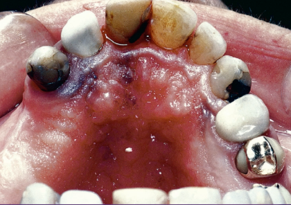 <p>what is the most likely diagnosis </p>