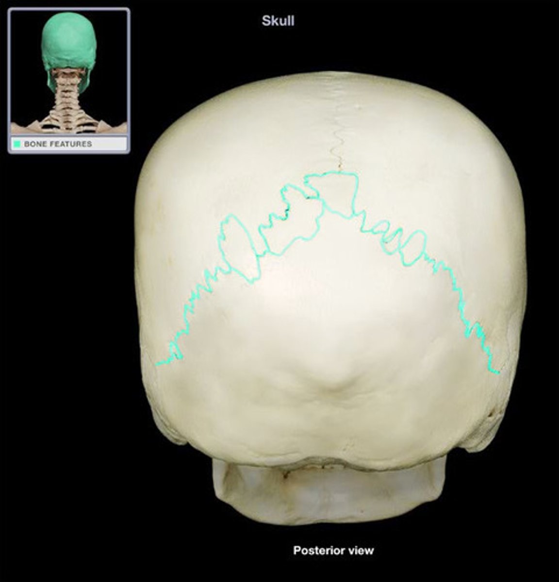 <p>junction between the parietal and occipital bones</p>