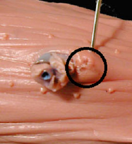 A small mound just posterior to the umbilical cord on the ventral side