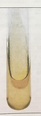 <p>what does it mean if phenylalanine is neg&nbsp;</p>