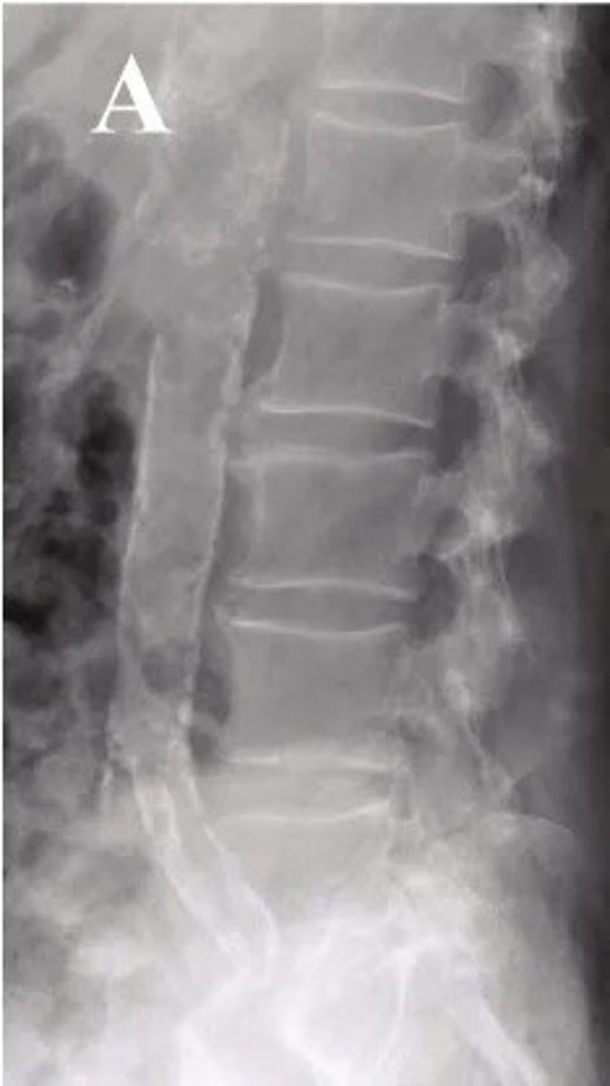 <p>what pathology is present?</p>