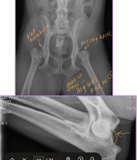 <p><span style="background-color: transparent;"><span>Diagnosis of Osteoarthritis</span></span></p>