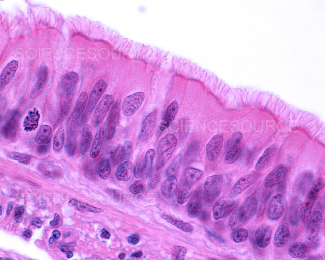 <p>pseudostratified columnar epithelium</p>