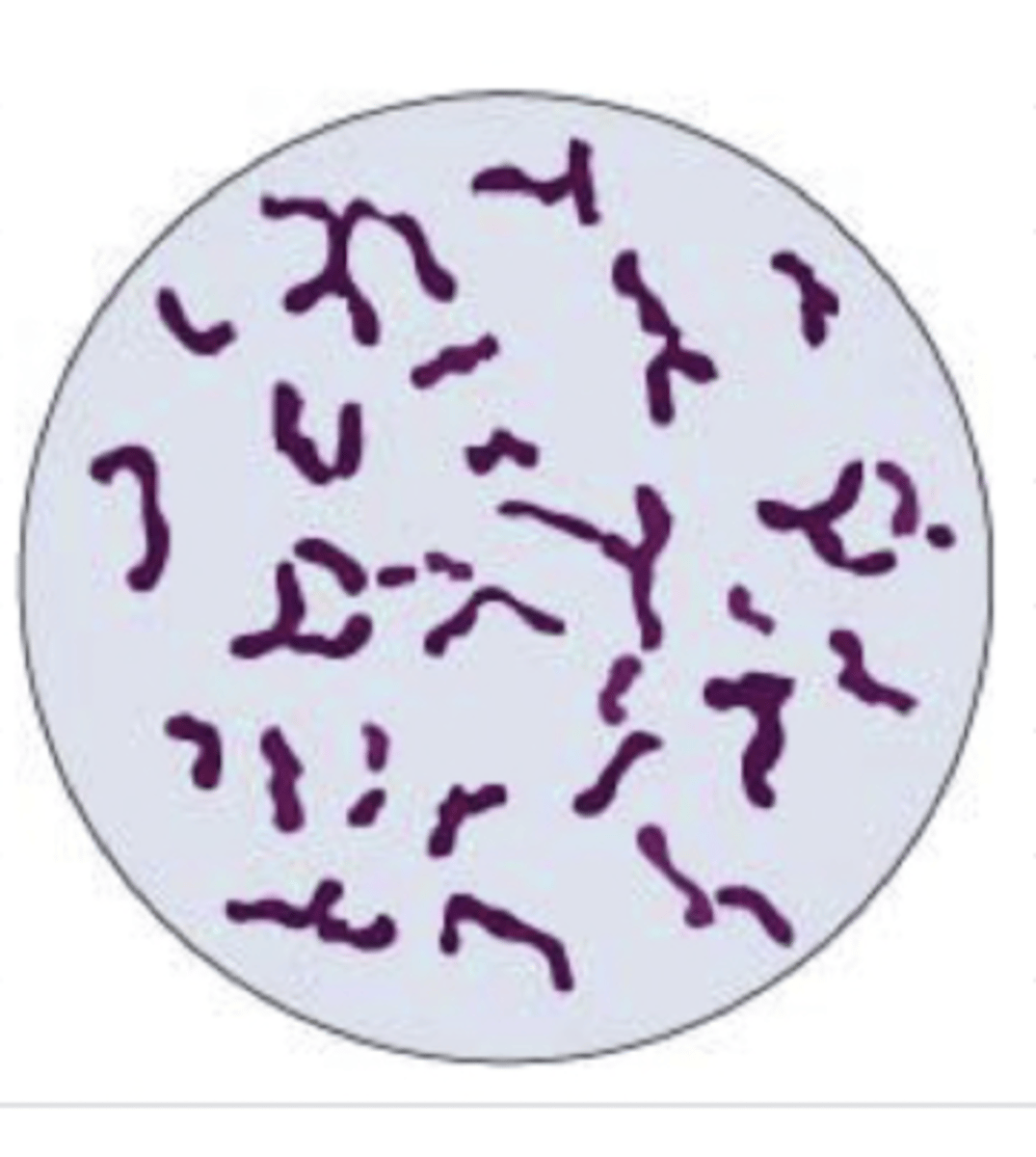 <p>what bacteria is this?</p>
