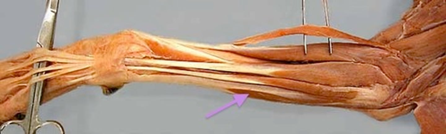 <p>What muscle is this?</p><p>Origin?</p><p>Insertion?</p><p>Action?</p><p>Nerve?</p>