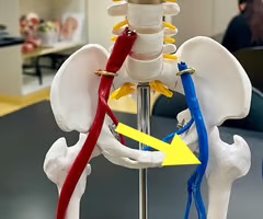 <p>Name the blood vessel.</p>