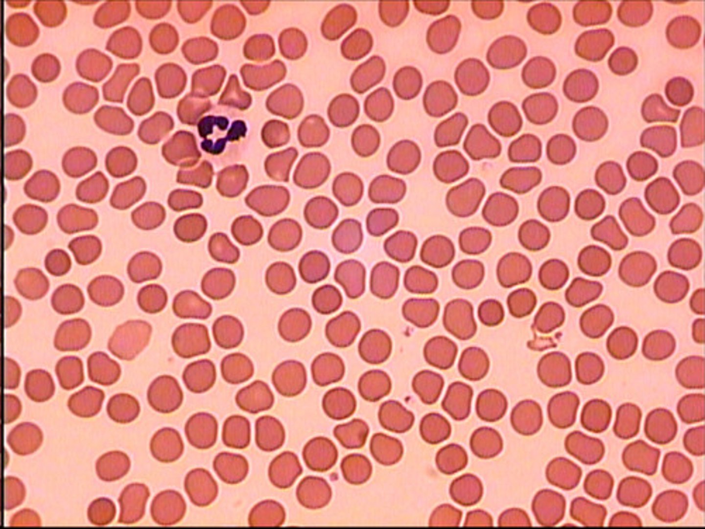 <p>has watery matrix - plasma</p><p>cells form concentric rings around central canal.</p><p>found in circulatory system</p><p>function: transports cells, dissolved nutrients, dissolved waste material, come CO2, chemicals (hormones, enzymes, etc.)</p>