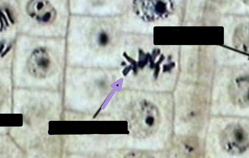 <p>what stage of cell division is this? </p>