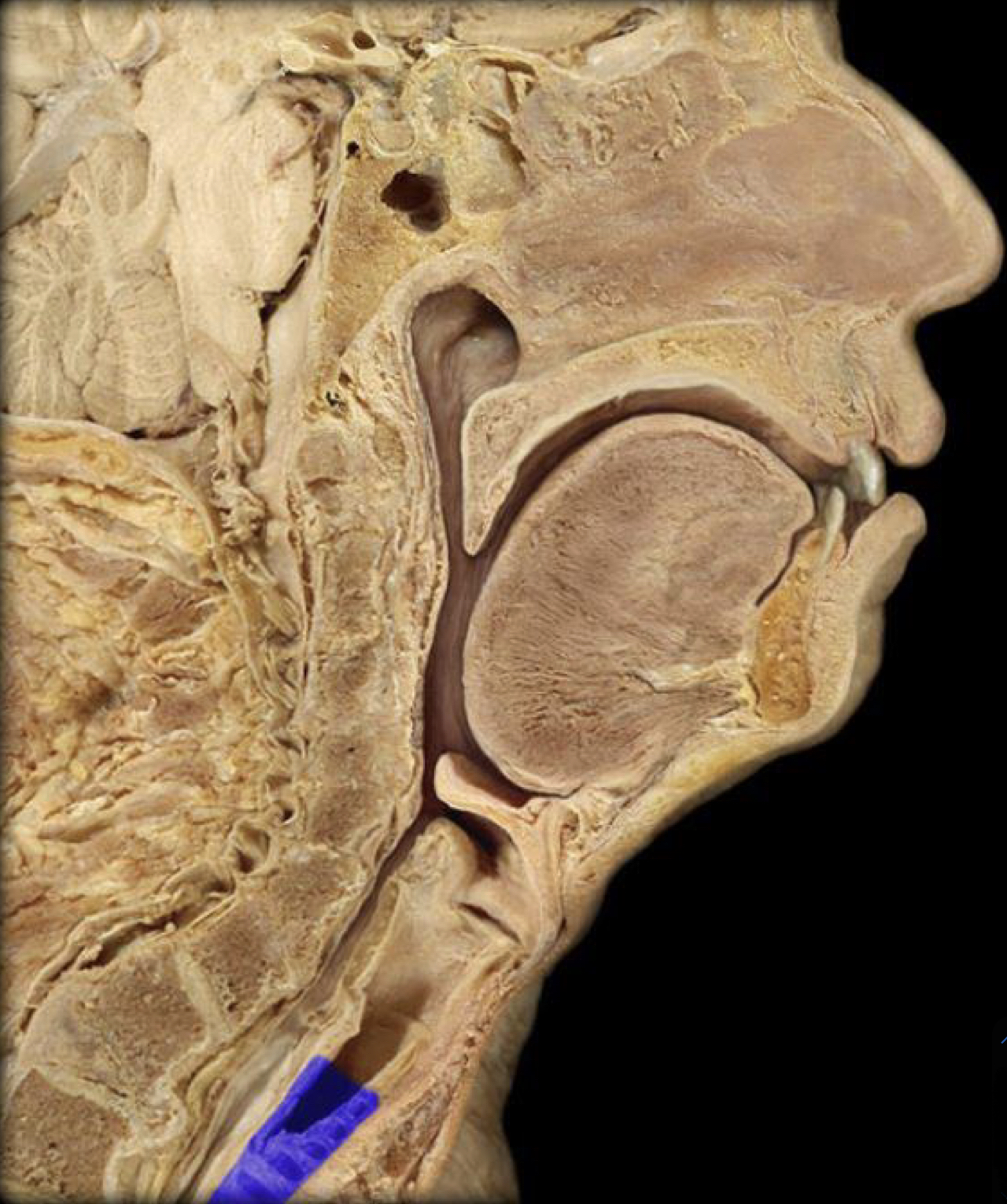 What structure is highlighted in blue?