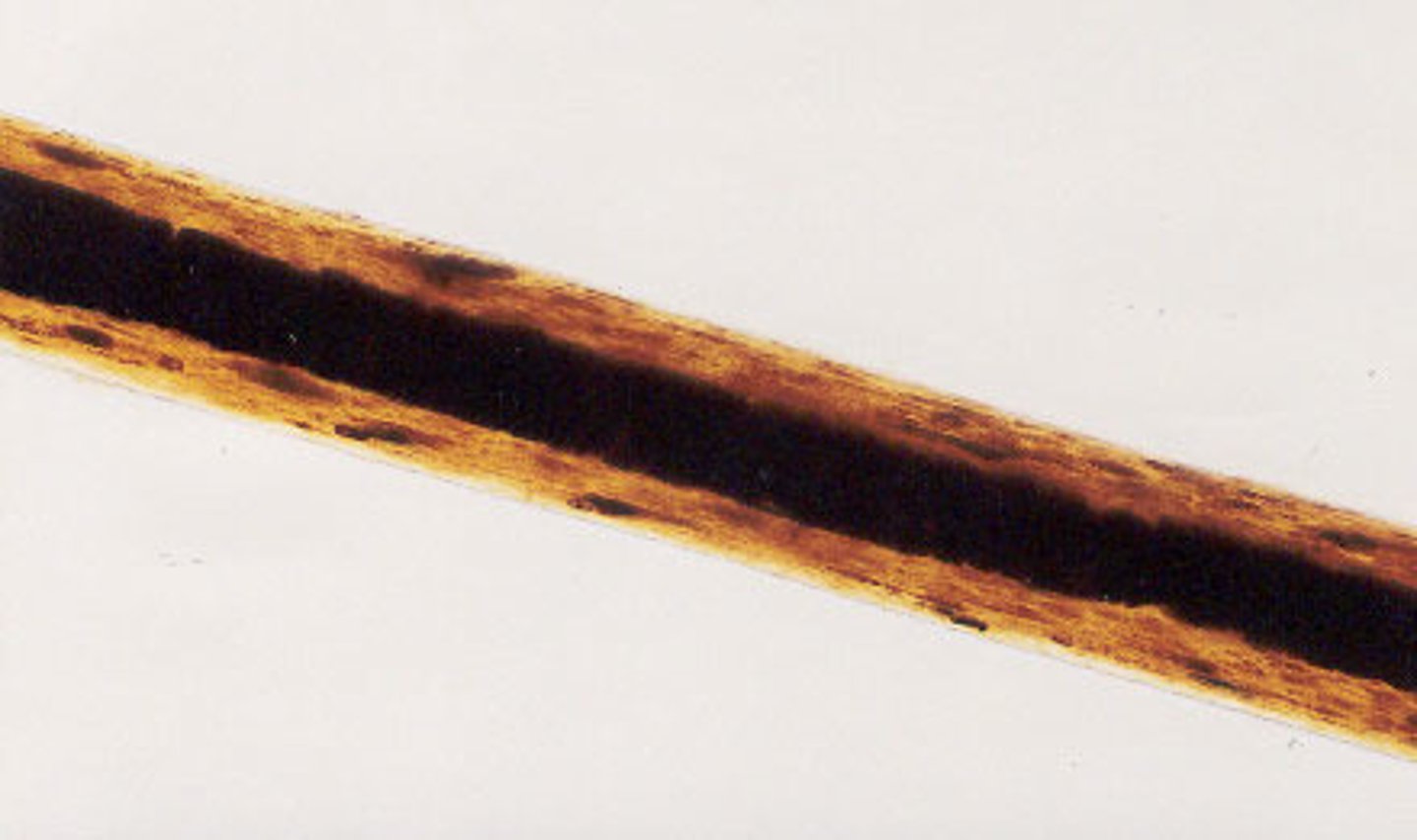 <p>- can be coarse or fine, depending on location hair is from</p><p>medulla is continuous, vacuolated to amorphous,</p><p>- occasionally very broad</p><p>- scales of cuticle not very visible</p>