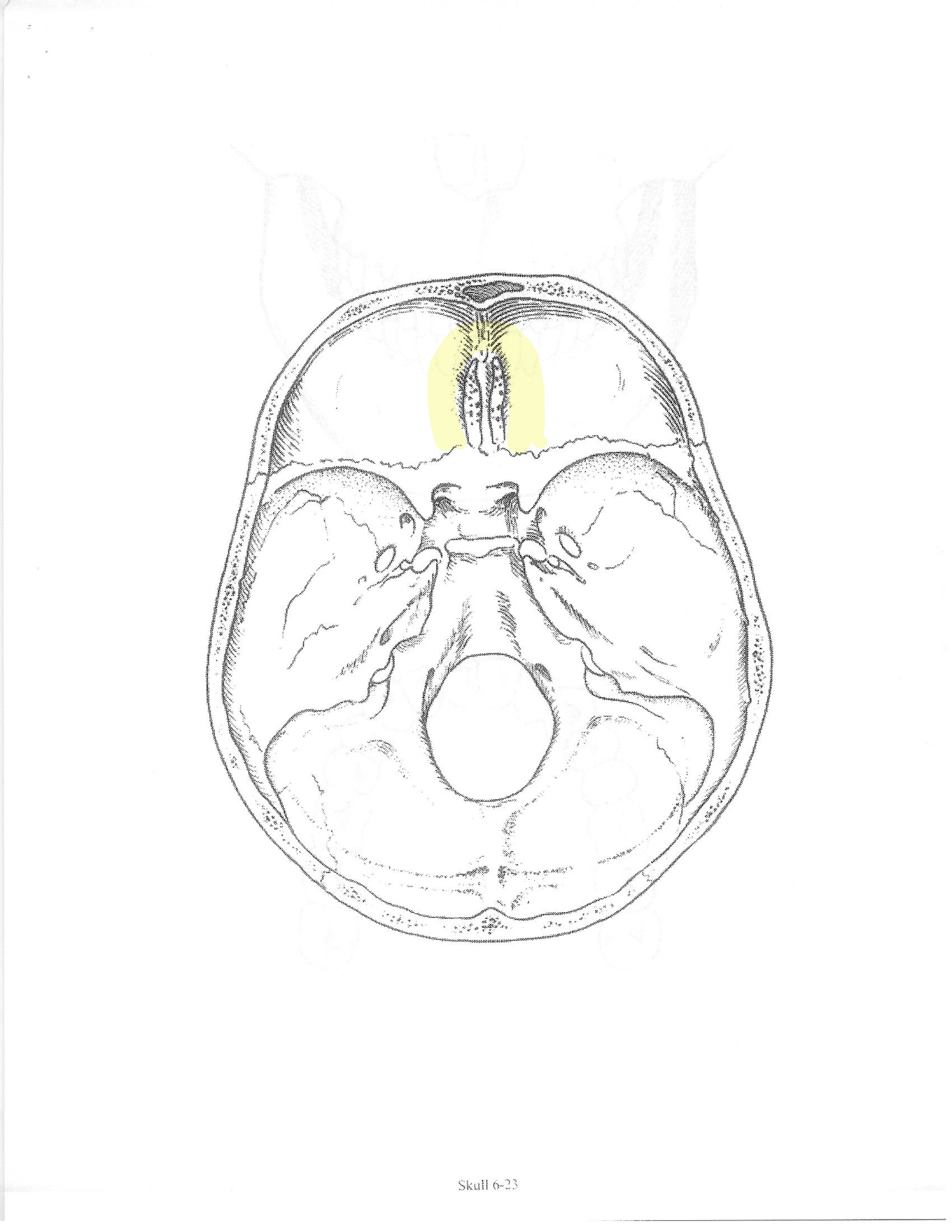 <p>ID bone</p>