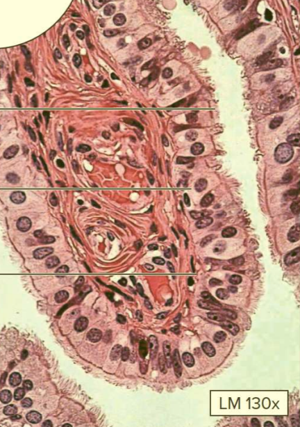 <p>What type of tissue?</p>
