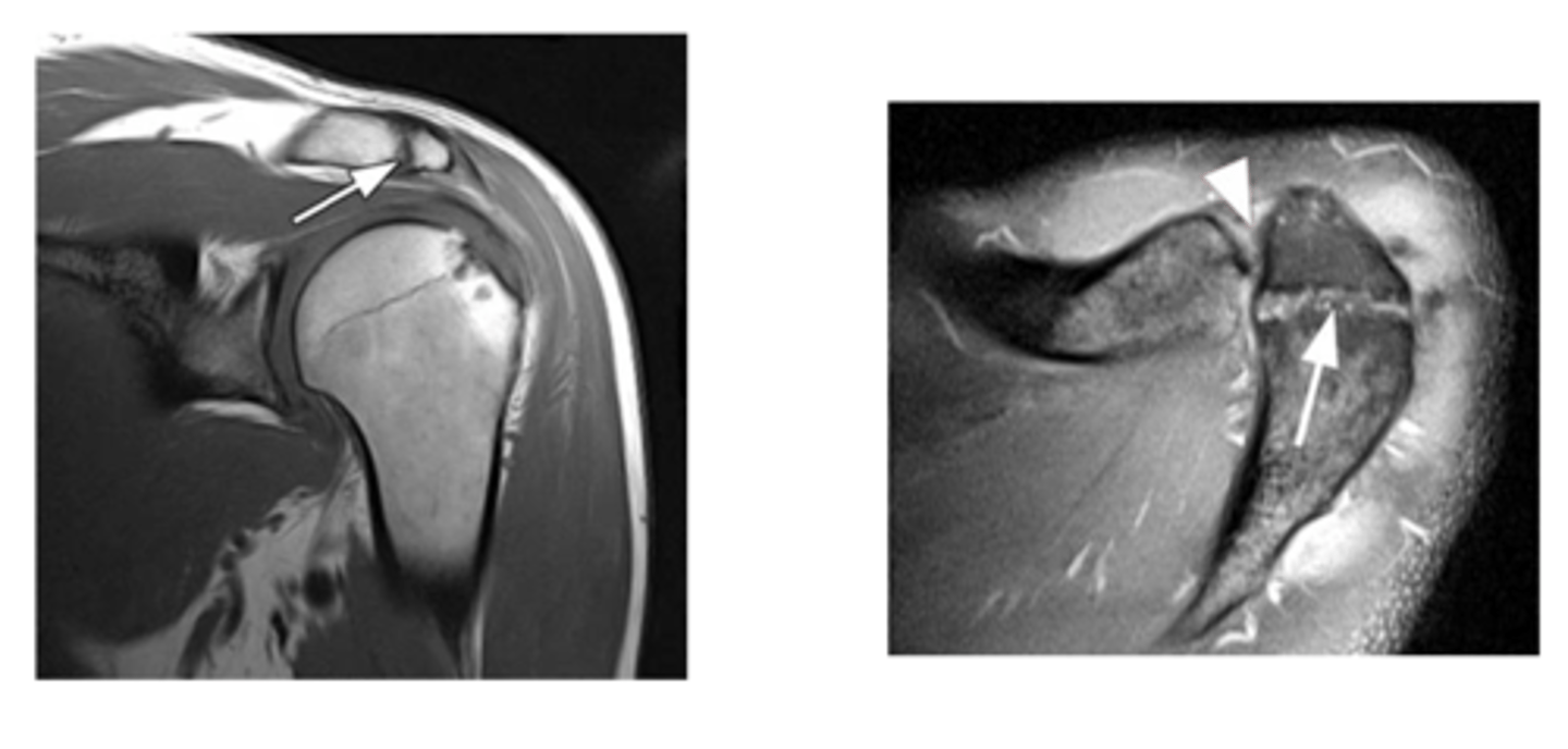 <p>What are these images depicting at the ACJ?</p>