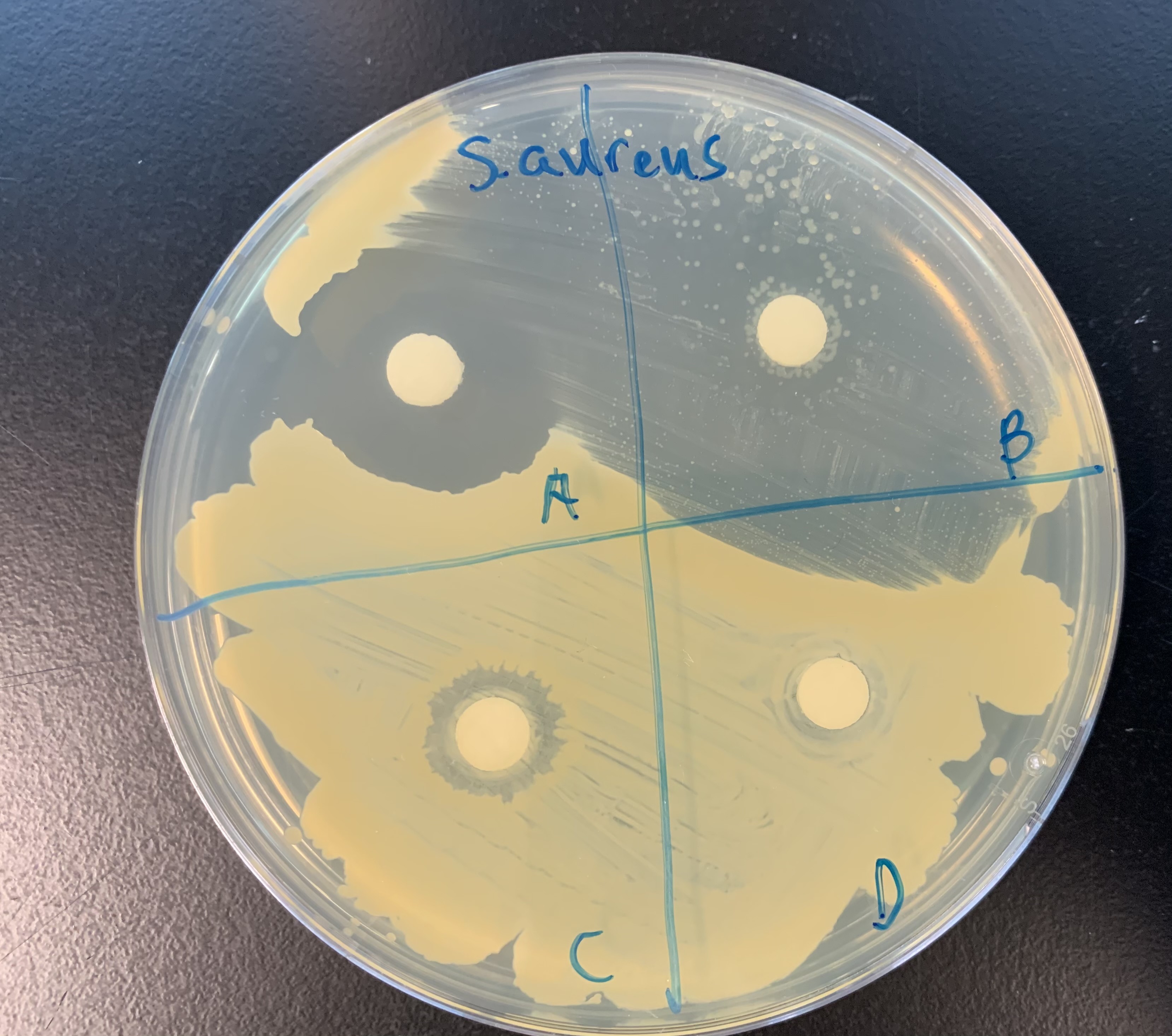 <p>#33 Zone of Inhibition </p>