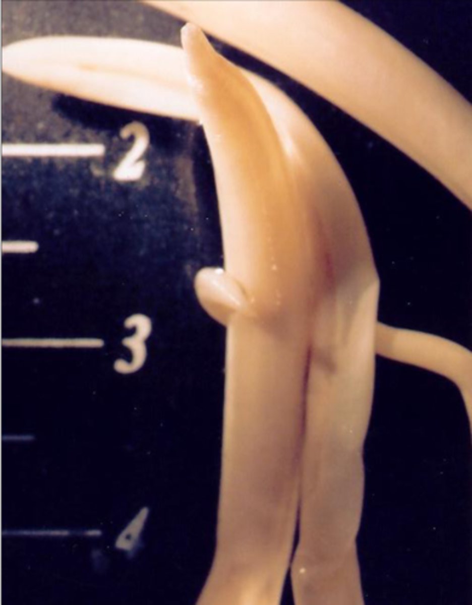 <p>Found in pigs in dirty environment who are failing to gain weight. What parasite is this?</p>