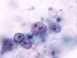 term image