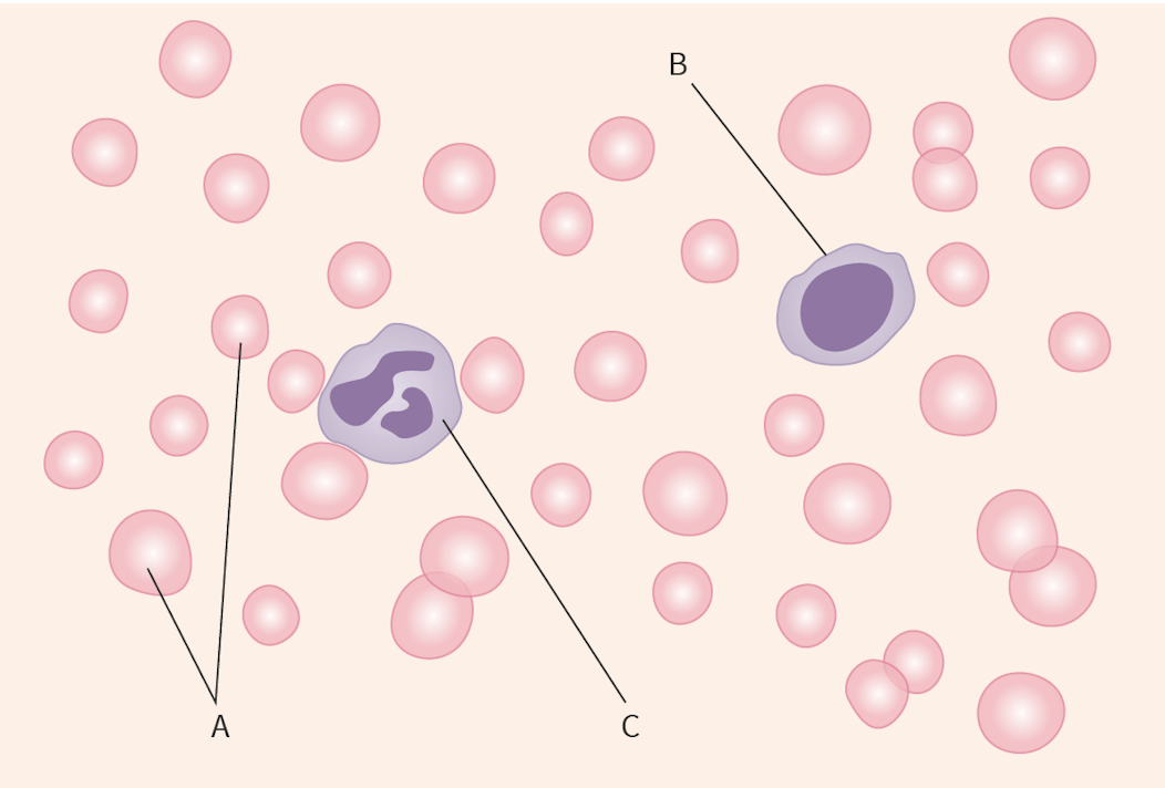 <p>Identify red blood cells and white blood cells in the photo</p>