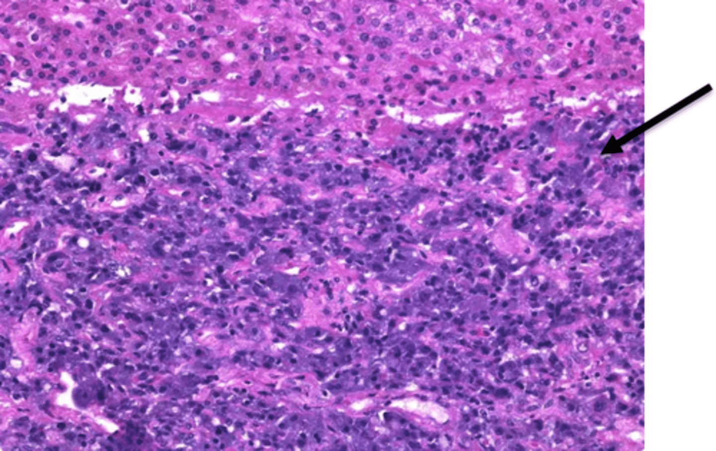 <p>deepest nervous tissue layer that secretes epi &amp; norepi. Under the control of the sympathetic nervous system.</p>