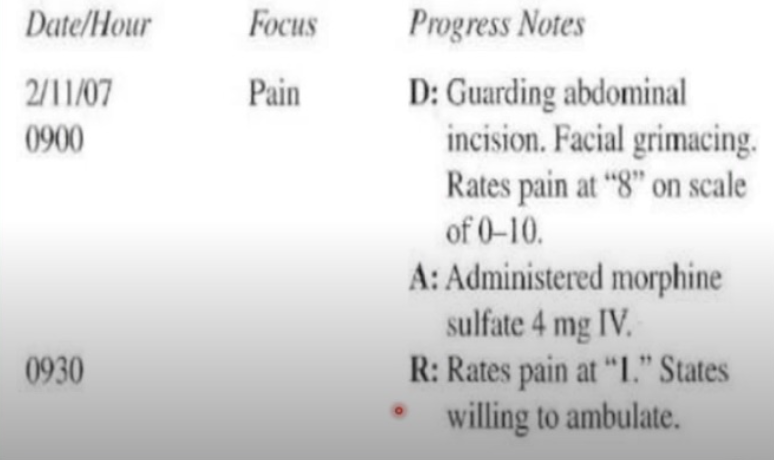 <p>Data, Action, Response (DAR)</p>