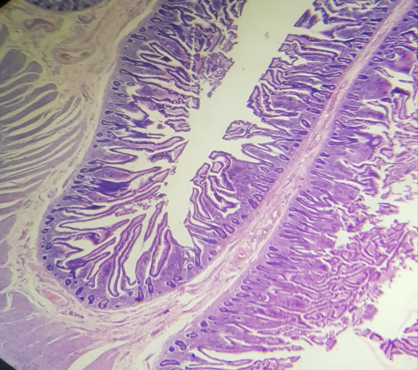 <p>Identify the structure and its characteristic feature</p>