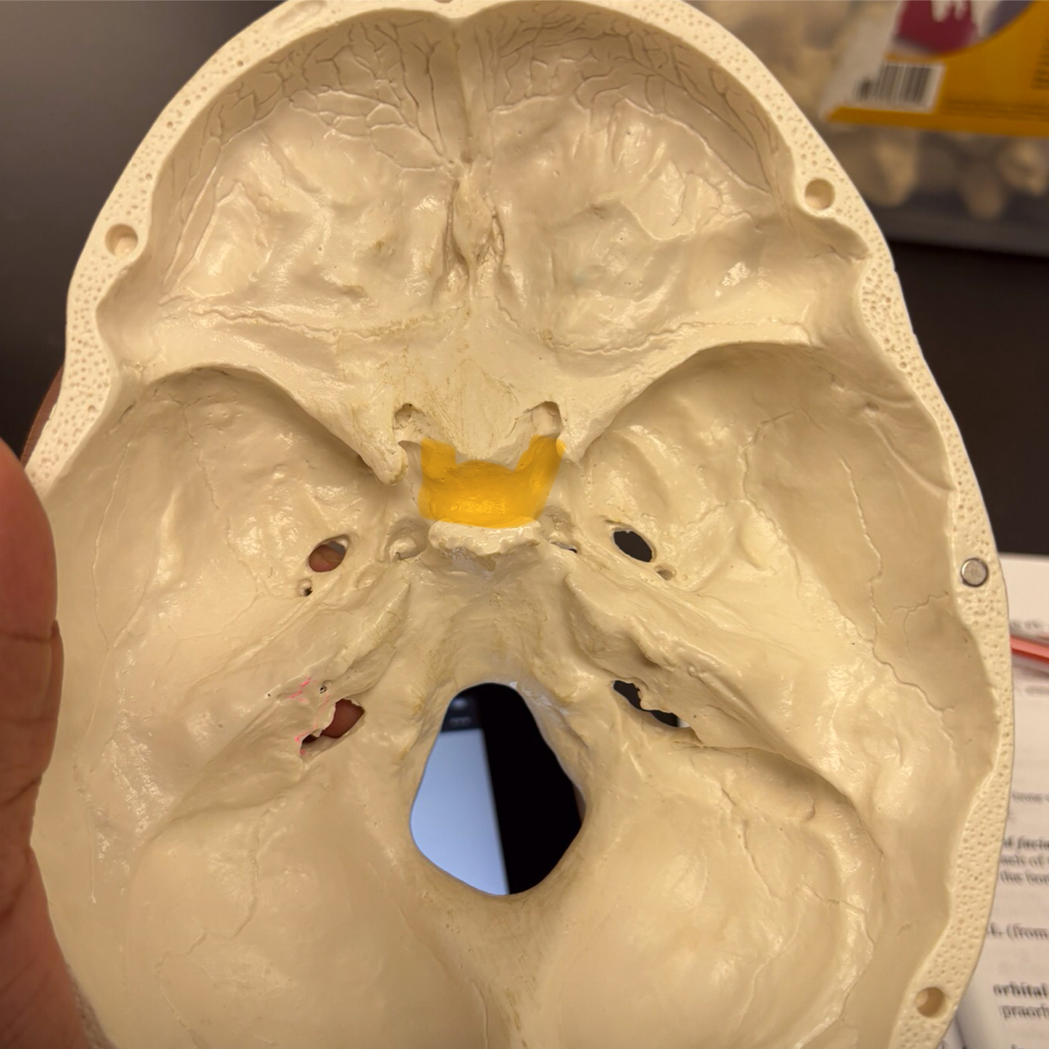 <p>turkish saddle: location of pituitary gland</p>