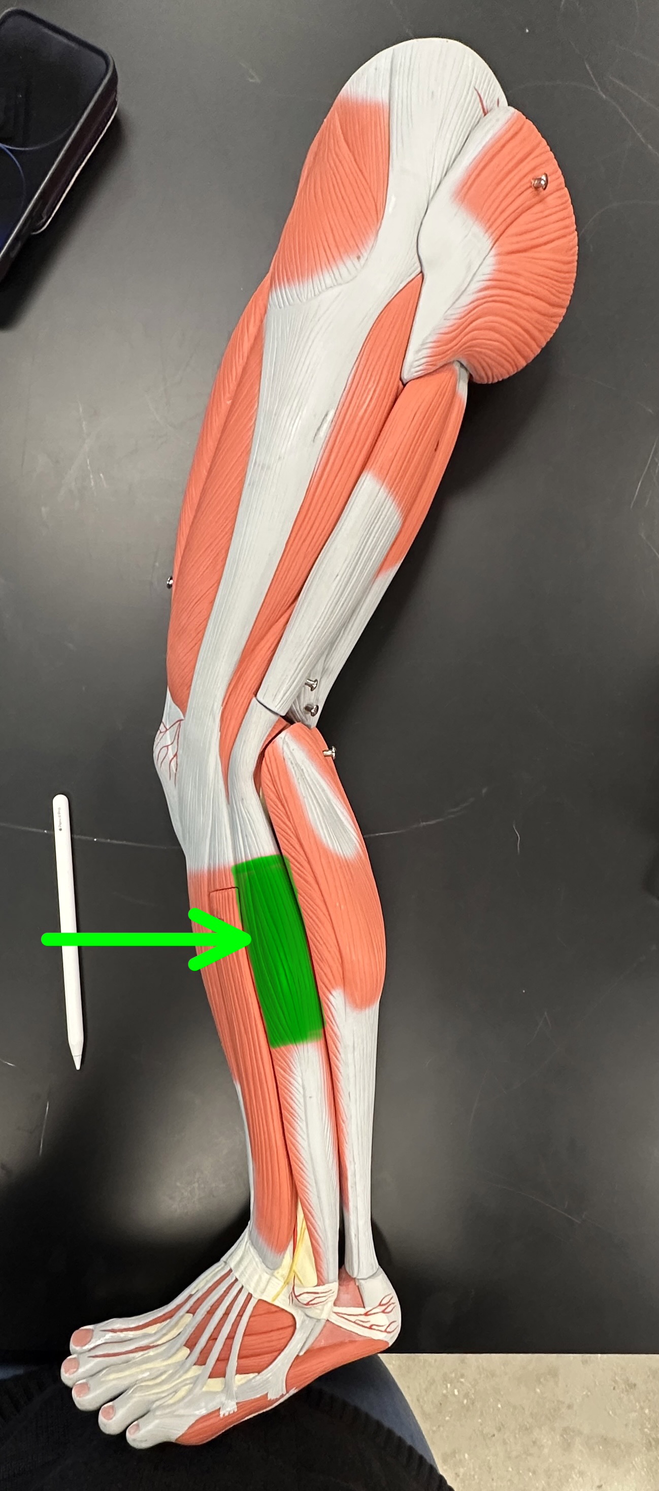 <p>What is the highlighted structure</p>