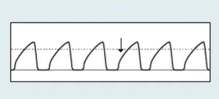 <p>which Capnography waveform is this</p>