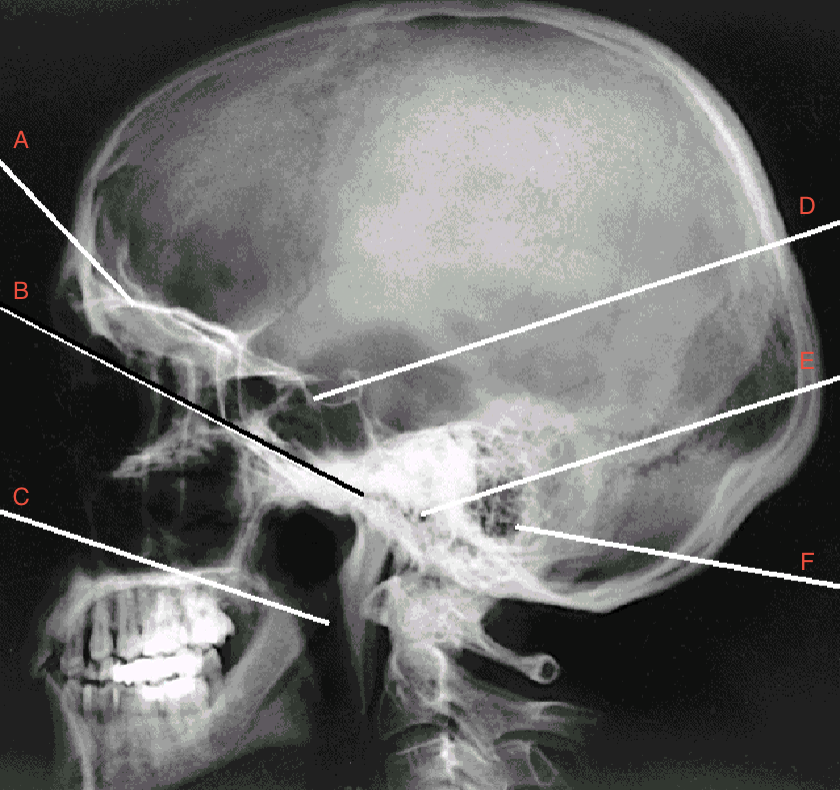 <p>what is C pointing to? </p>