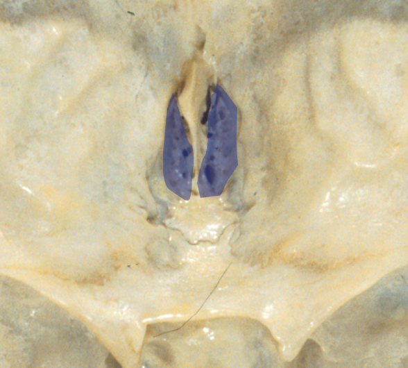 <p>What structure?</p>