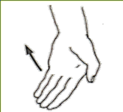 <p>What Movement is occurring?</p>