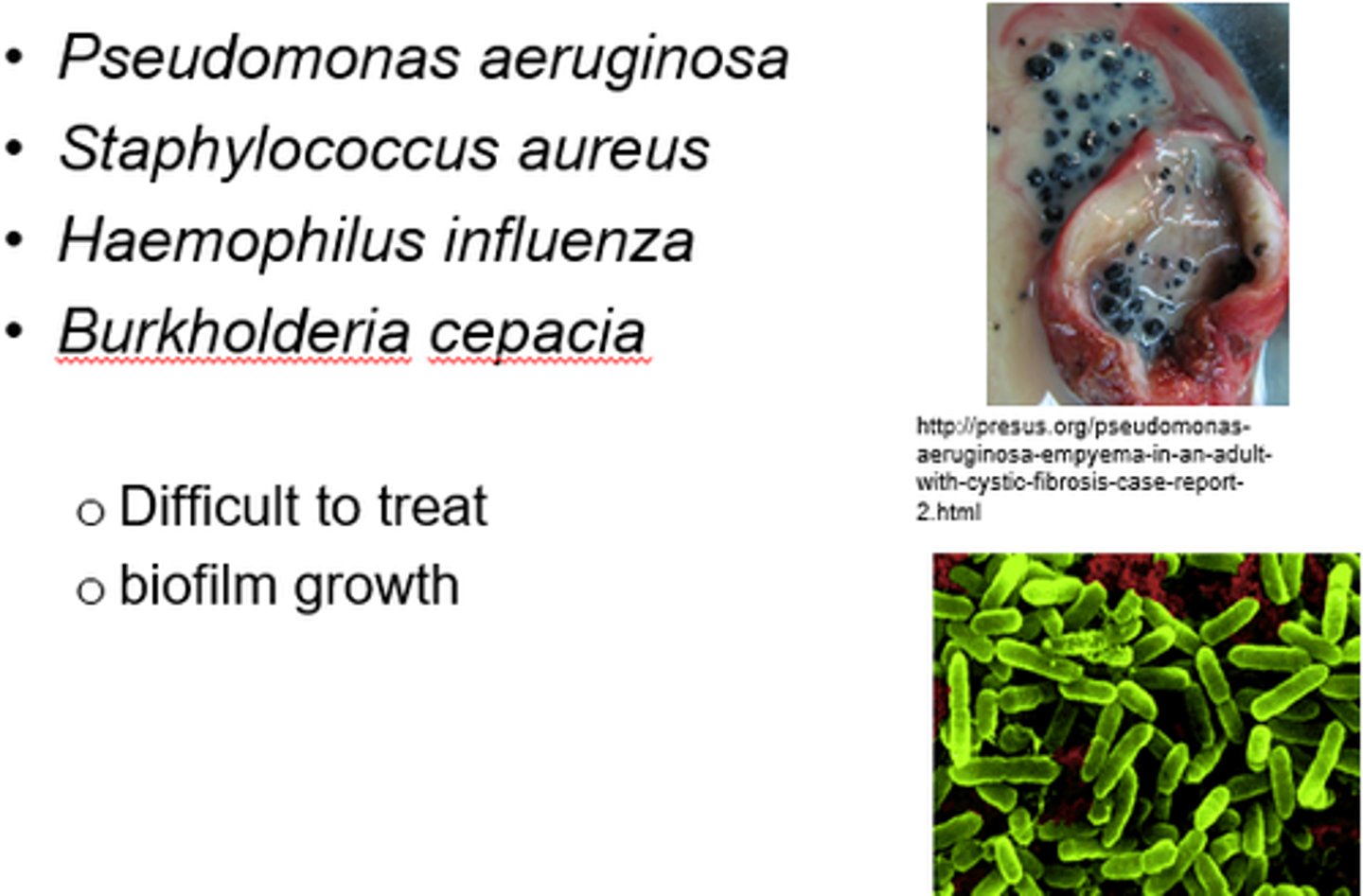 <p>Pseudomonas aeruginosa, Staphylococcus aureus, Haemophilus influenza.</p>