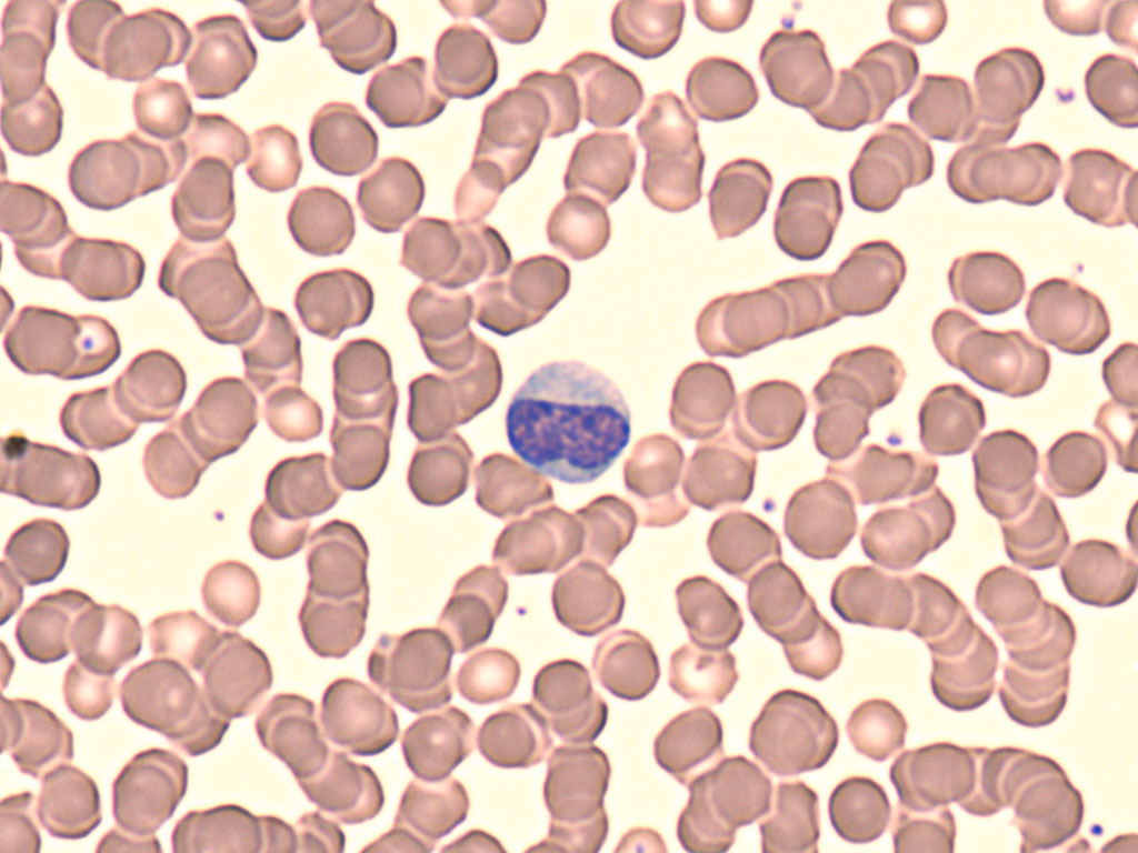 <p>What WBC is this? </p>