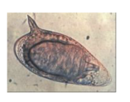 <p>What egg parasite is this?</p>