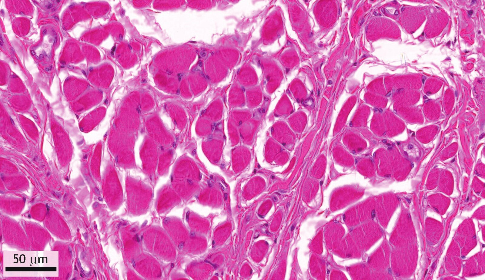 <p>12. The image shows a tissue section.</p><p>Which molecule in this tissue has elastic properties and stretches from the Z-line (Z-disc) to the M-band (M-line)?</p><p>A. Actin</p><p>B. Myosin</p><p>C. Titin</p><p>D. Elastin</p><p>E. Aggrecan</p>