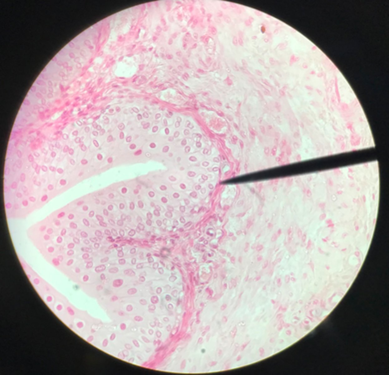 <p>What organ is depicted on this slide?</p>
