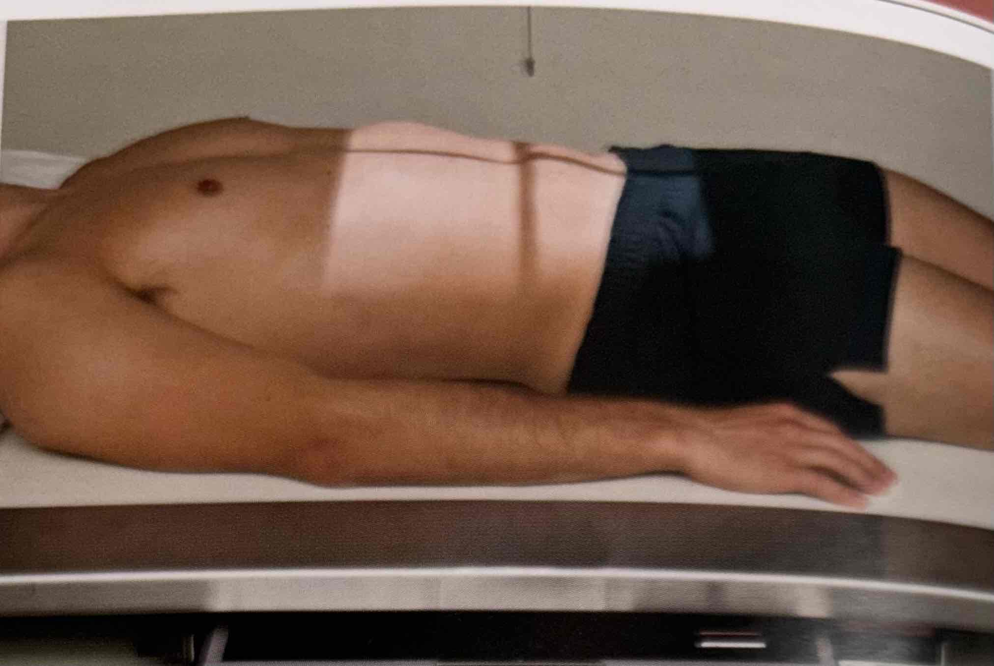 <p>what exam is the patient in position for</p>
