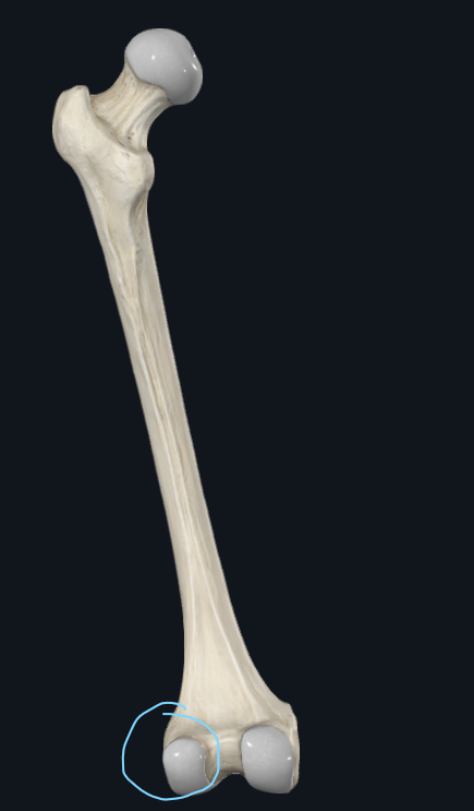 <p>What is this part of the femur called</p>