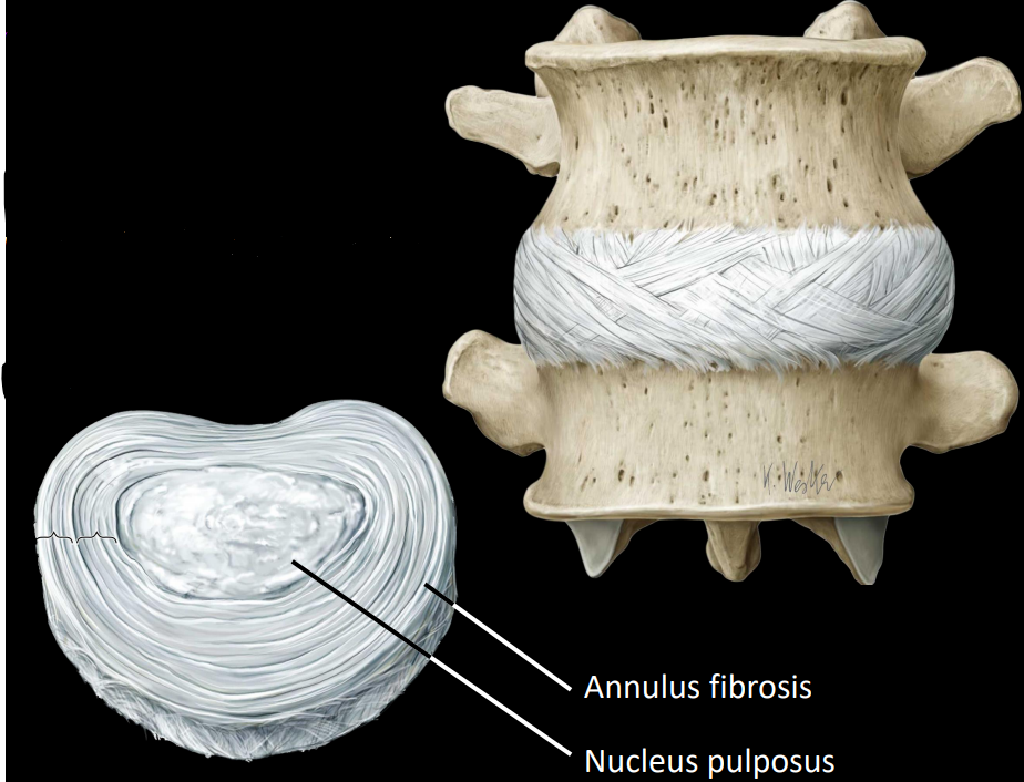 <p><strong>annulus fibrosis</strong> - ring of fibrosis tissue</p><p><strong>nucleus pulposus </strong>- core of gel-like substance</p>