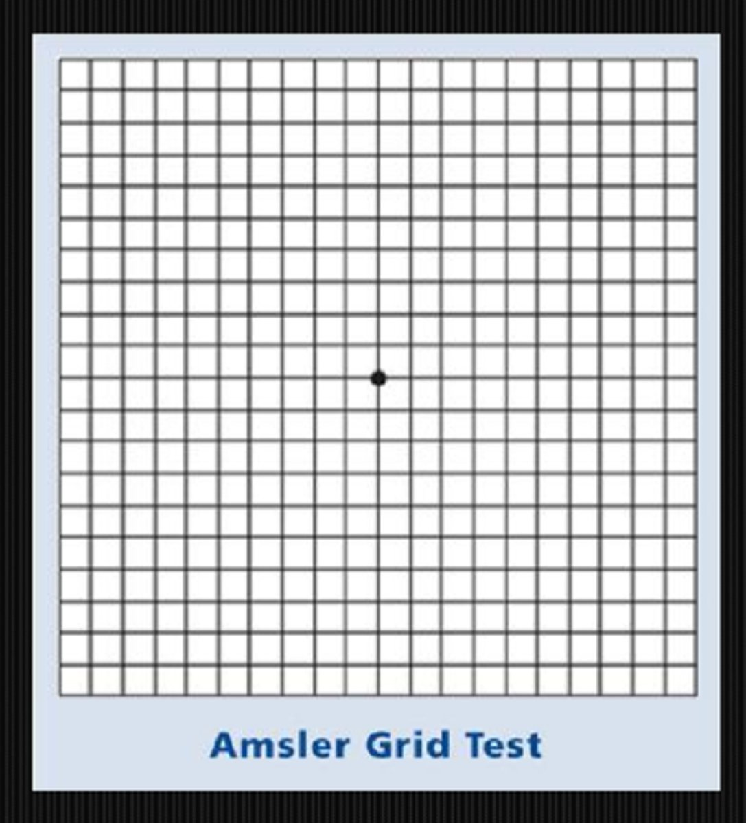 <p>at 30cm, each square subtends 1 deg of retina = good for central scotomas, etc</p>