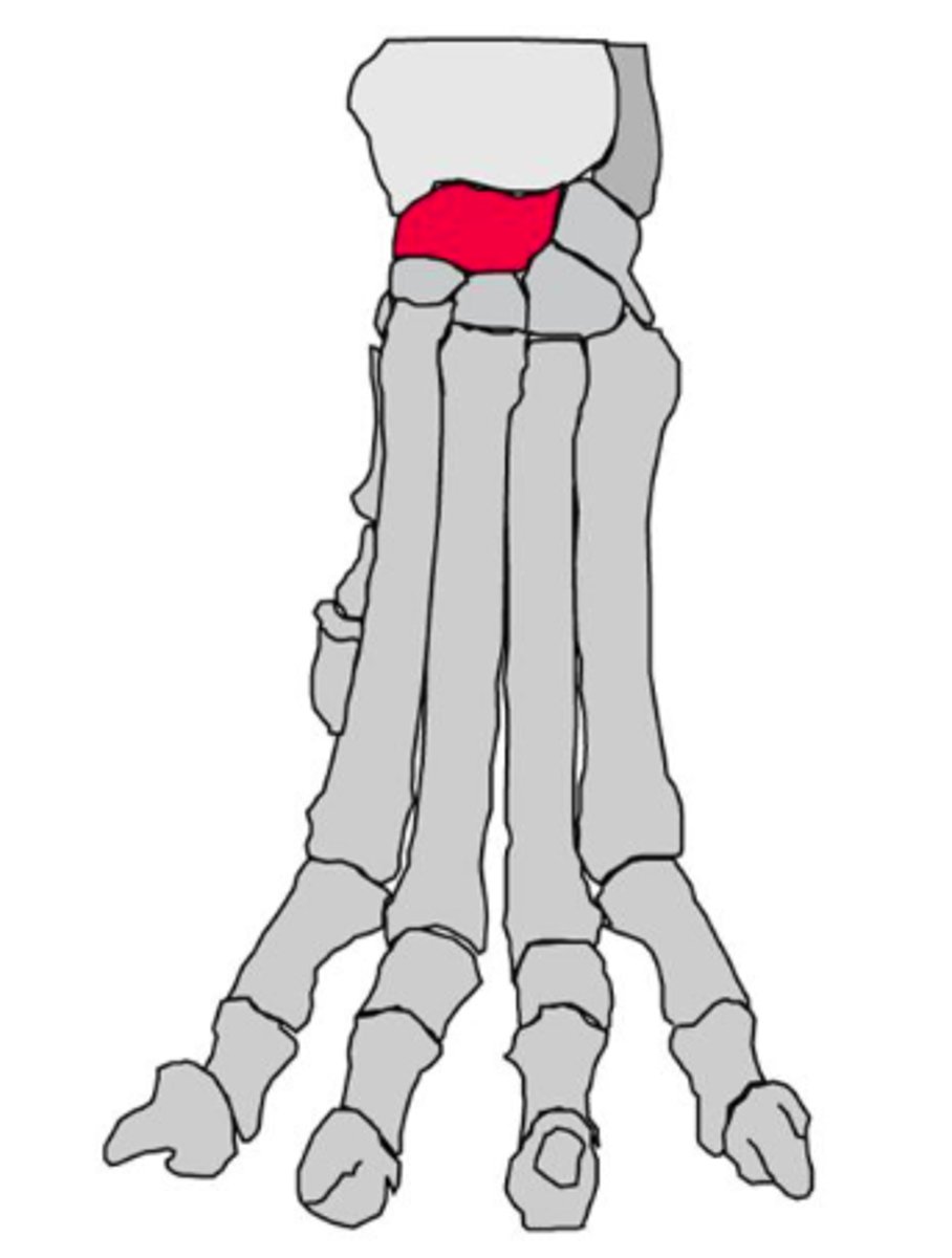 <p>carpal bone on medial side and articulates proximally with the radius</p>